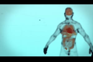 人体解剖学UI介绍标题身体脑心脏十二指肠FUI肠肝脏ae模板素材_科技展示ae模板