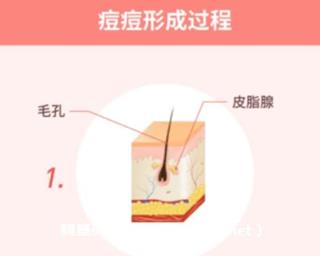 丁香妈妈 科学战痘攻略（完结）网盘