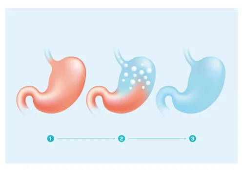 人体器官胃和消化系统矢量插图设计素材Human\'s Stomach and digestive