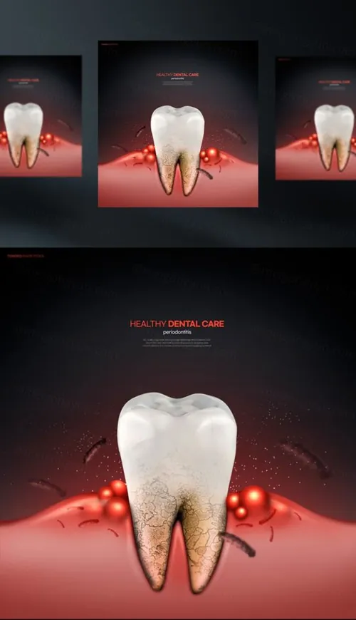 牙齿清洁修护保护牙医院卫生治疗宣传PSD海报模板 Health Dental Care