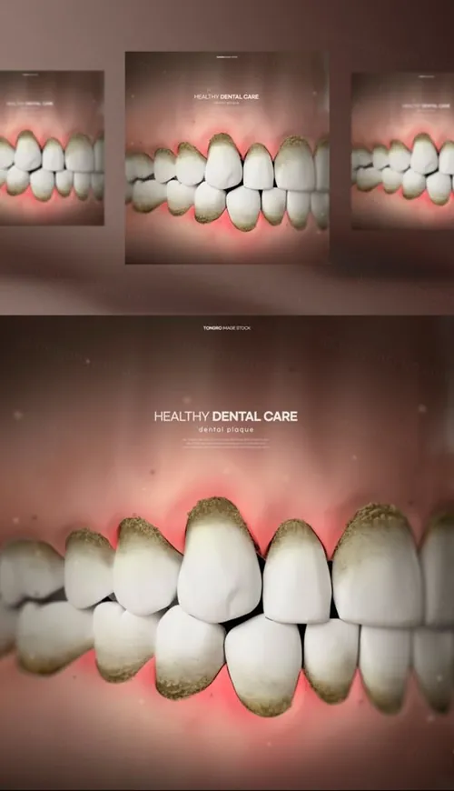 牙齿清洁修护保护牙医院卫生治疗宣传PSD海报模板 Health Dental Care