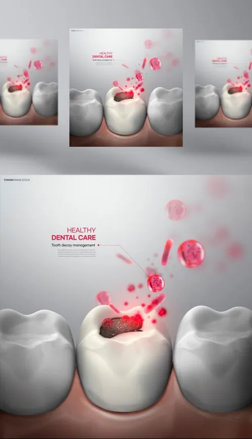 牙齿清洁修护保护牙医院卫生治疗宣传PSD海报模板 Health Dental Care