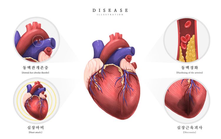 医院肌肉心脏动脉静脉研究医学疾病器官插画素材